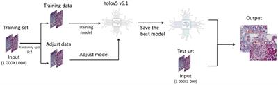 Artificial intelligence can accurately distinguish IgA nephropathy from diabetic nephropathy under Masson staining and becomes an important assistant for renal pathologists